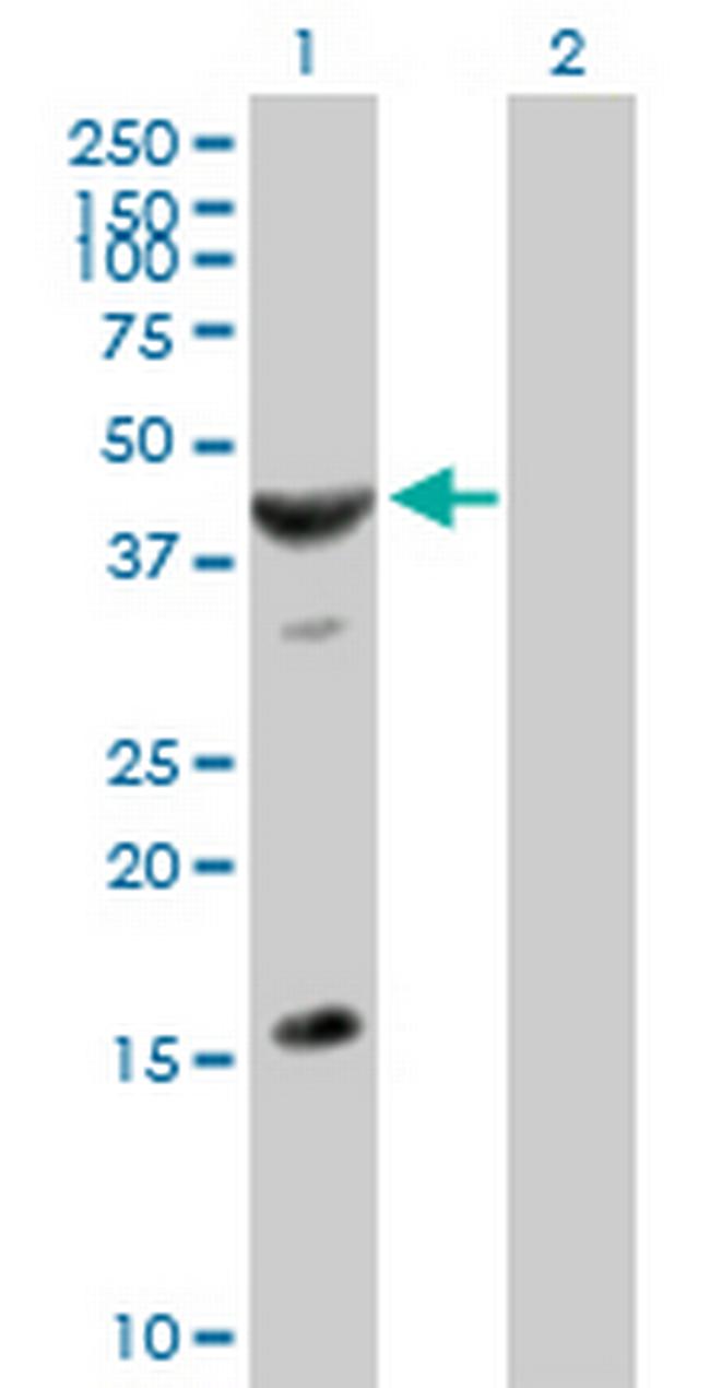 ASB6 Antibody in Western Blot (WB)