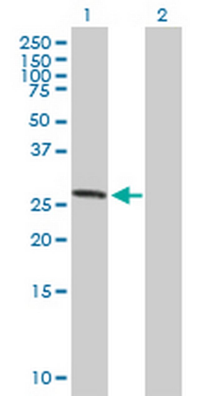 ASB7 Antibody in Western Blot (WB)