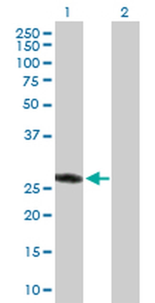 ASB9 Antibody in Western Blot (WB)