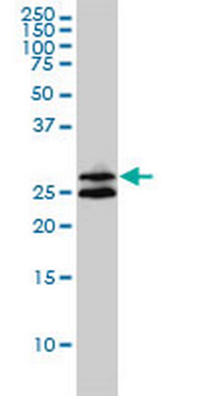 ASB9 Antibody in Western Blot (WB)
