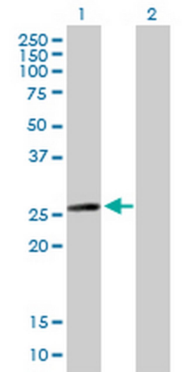 MYL6B Antibody in Western Blot (WB)