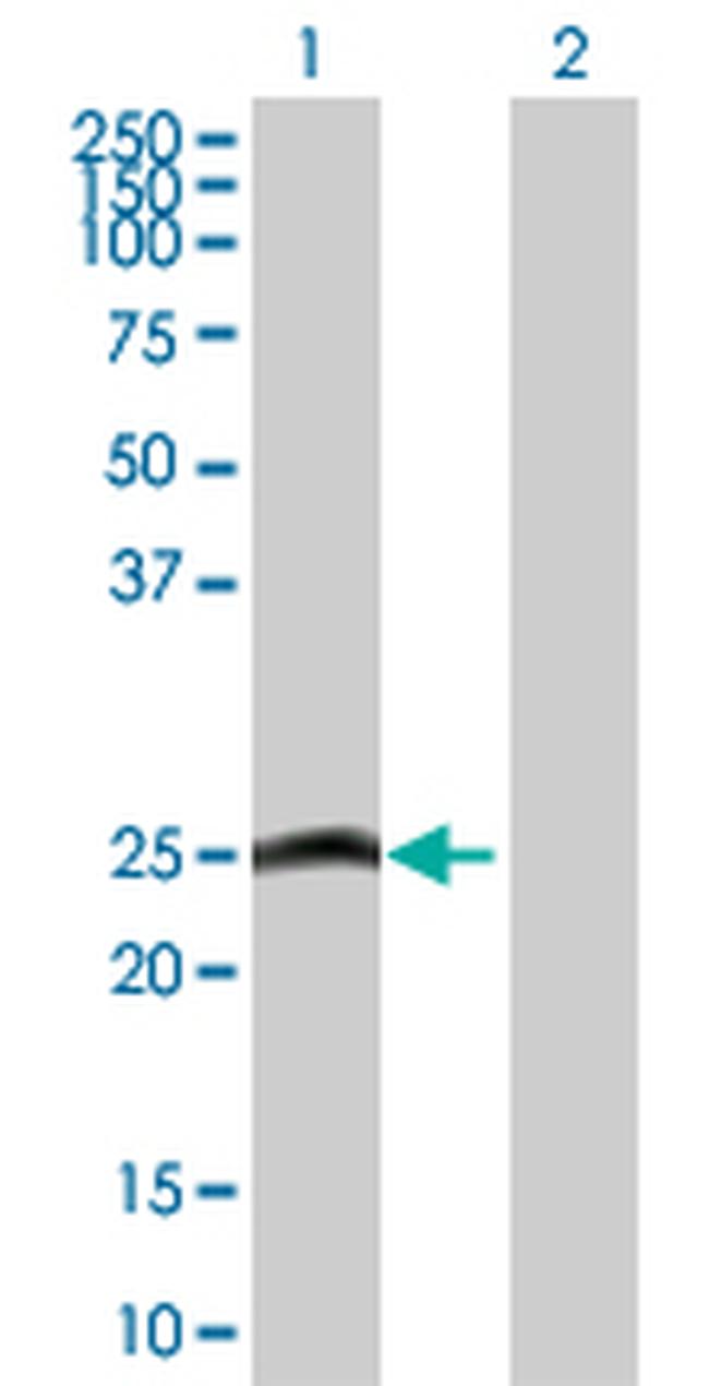 MYL6B Antibody in Western Blot (WB)