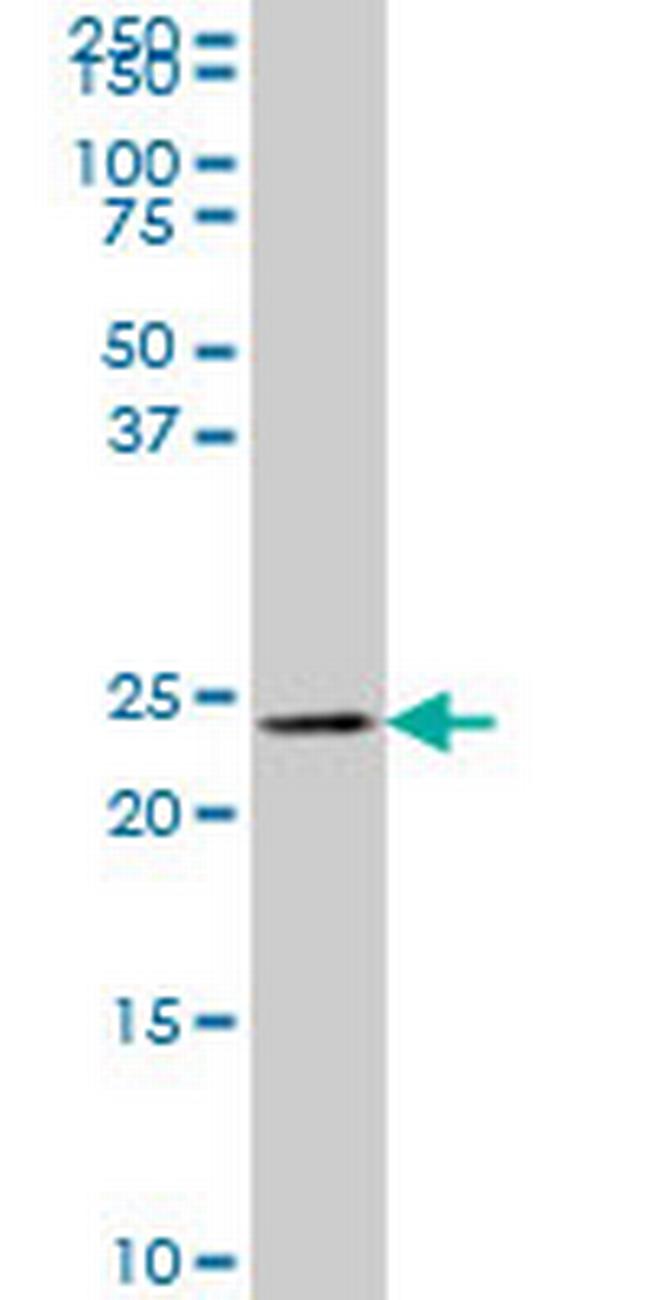 MLC1SA Antibody in Western Blot (WB)