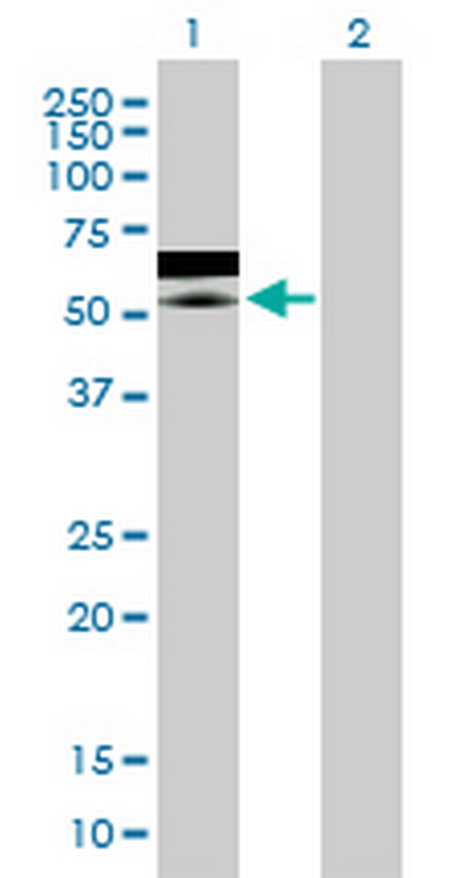 ZNF358 Antibody in Western Blot (WB)