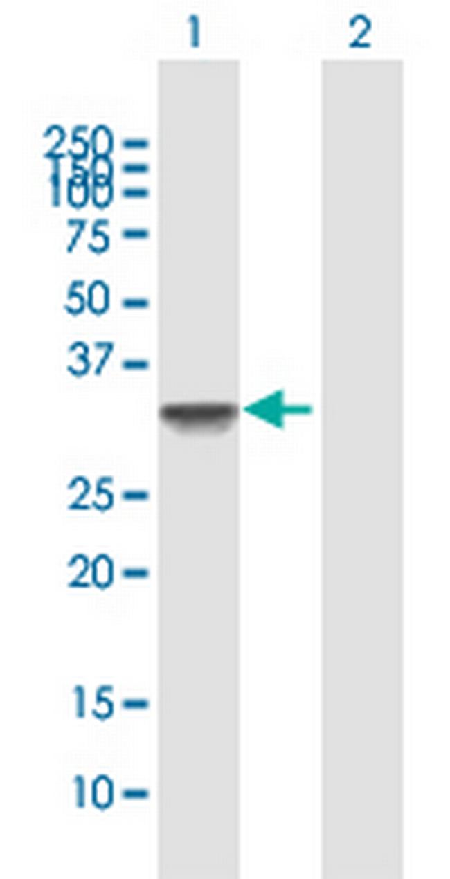 RNF32 Antibody in Western Blot (WB)