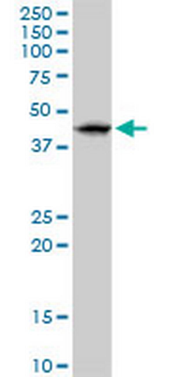 RNF32 Antibody in Western Blot (WB)