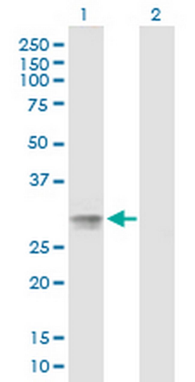 C20orf70 Antibody in Western Blot (WB)