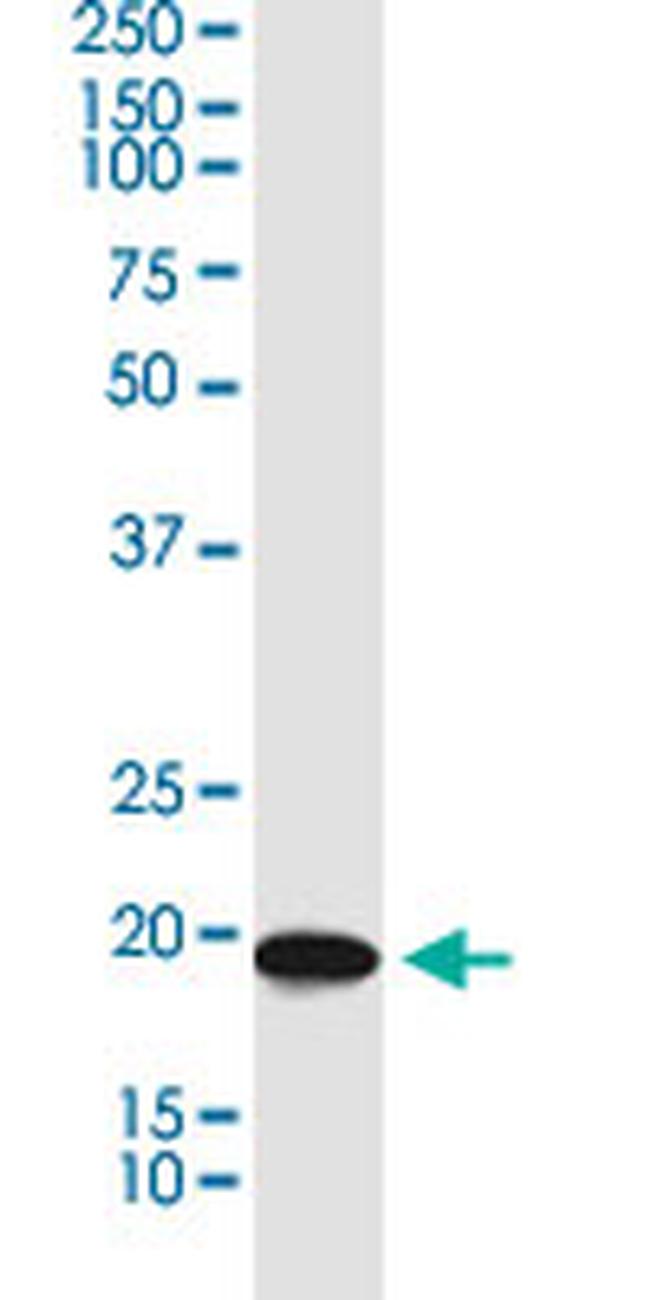 BRI3BP Antibody in Western Blot (WB)