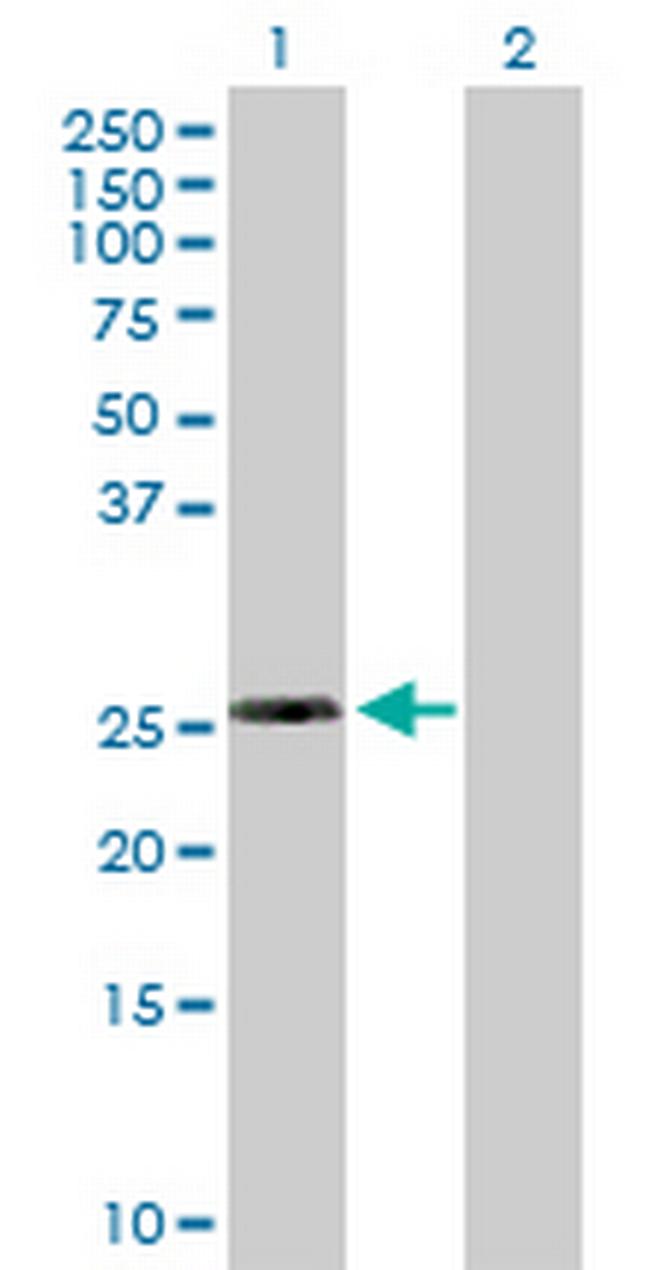 RPL10L Antibody in Western Blot (WB)