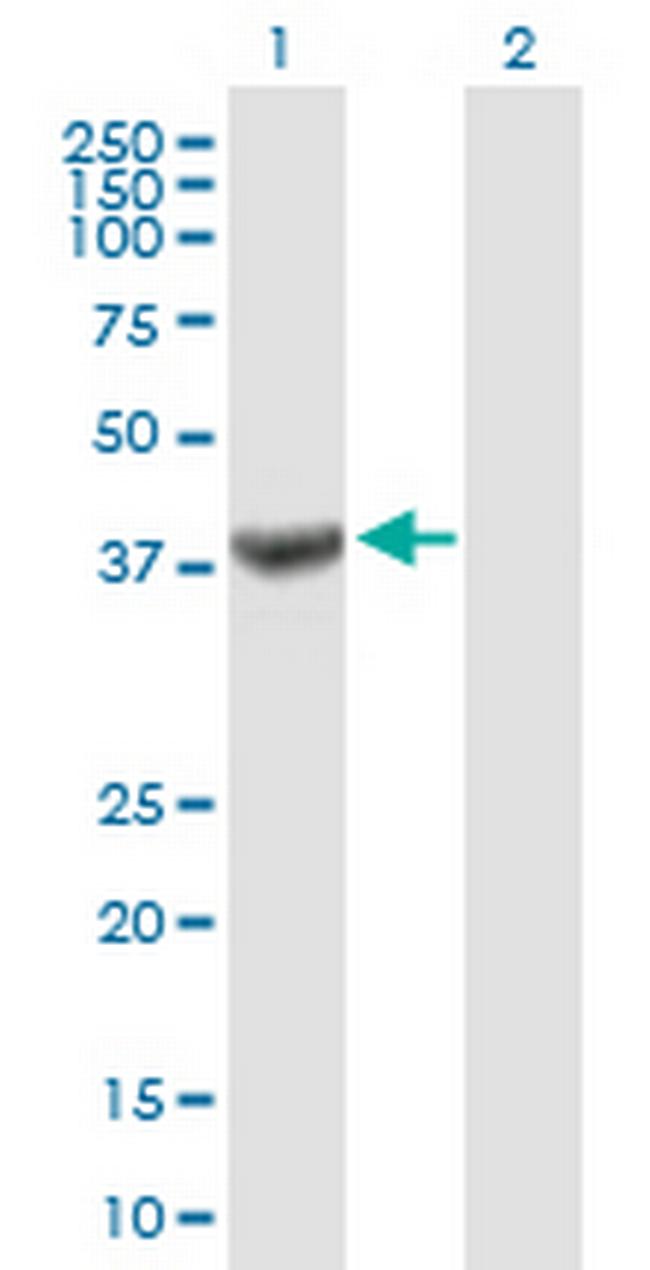 TRUB1 Antibody in Western Blot (WB)
