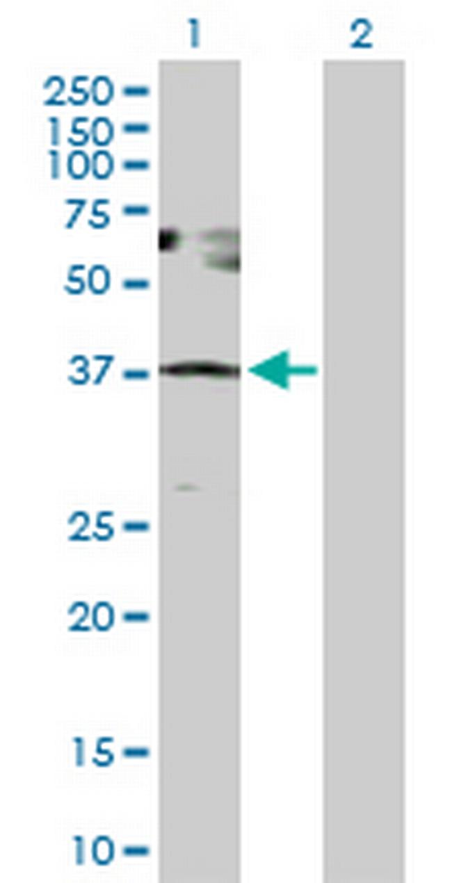 SESN3 Antibody in Western Blot (WB)
