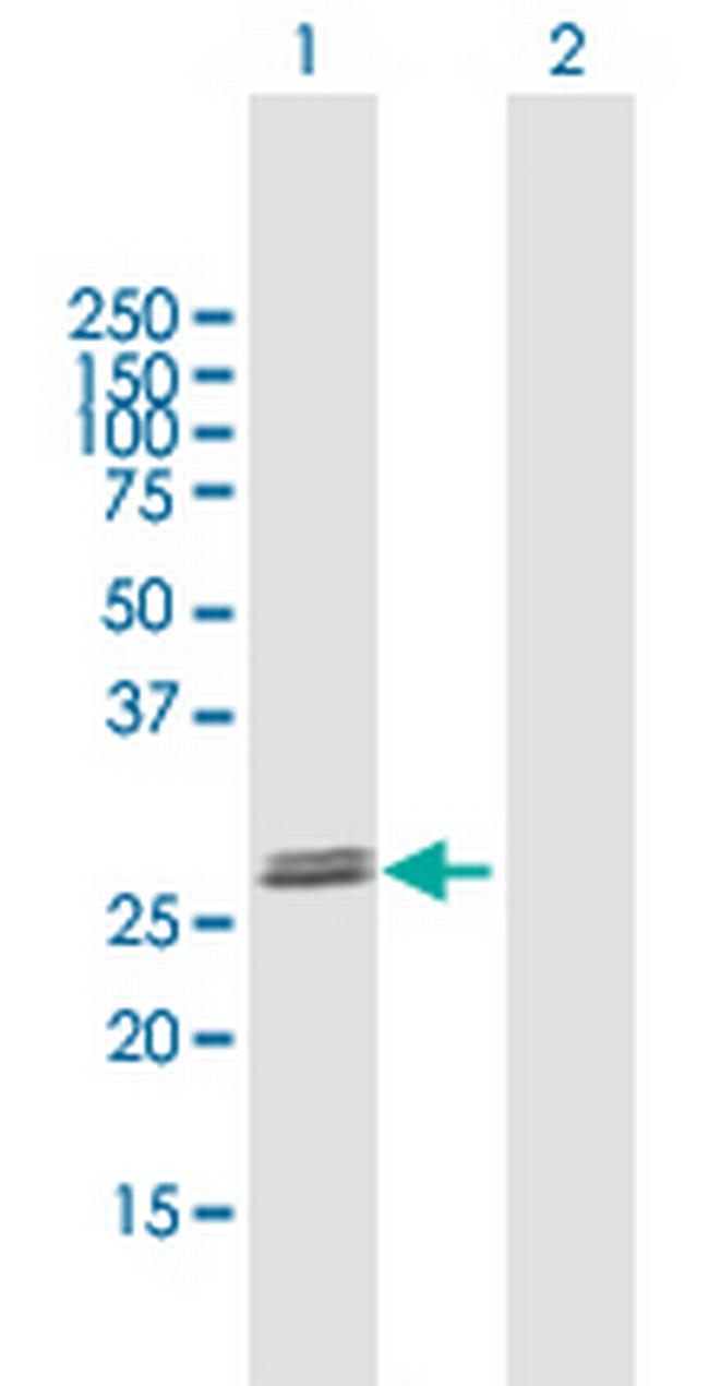 GLIPR1L2 Antibody in Western Blot (WB)