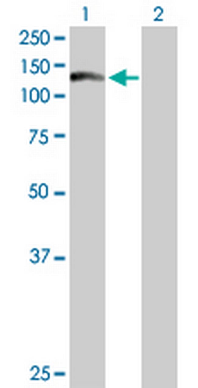 WDR66 Antibody in Western Blot (WB)