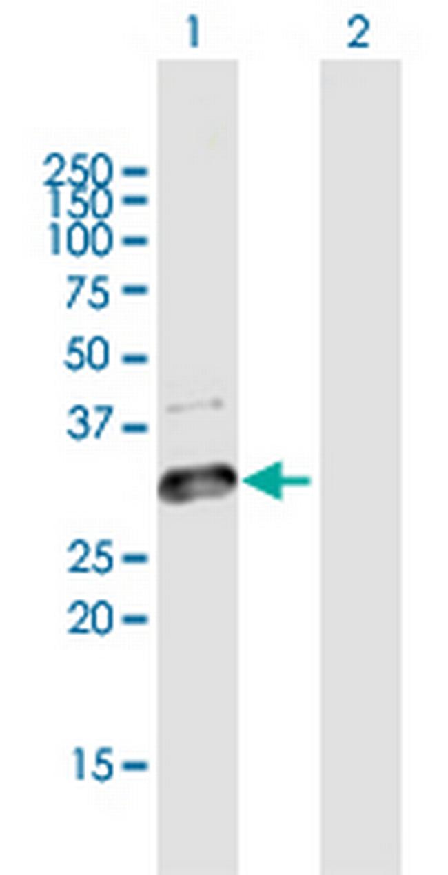 GLT1D1 Antibody in Western Blot (WB)