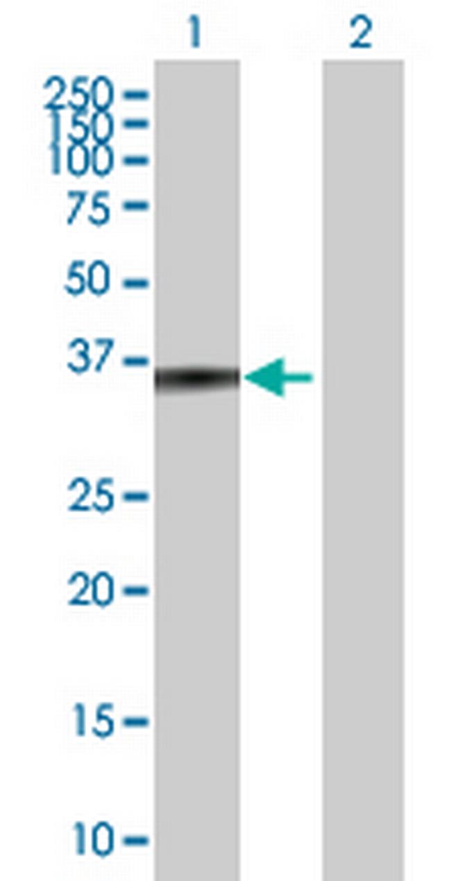 ZADH1 Antibody in Western Blot (WB)
