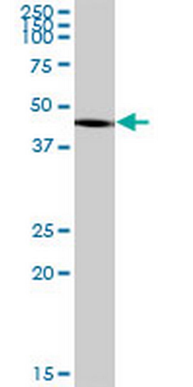 HAPLN3 Antibody in Western Blot (WB)