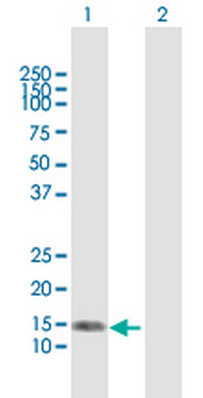NRG4 Antibody in Western Blot (WB)