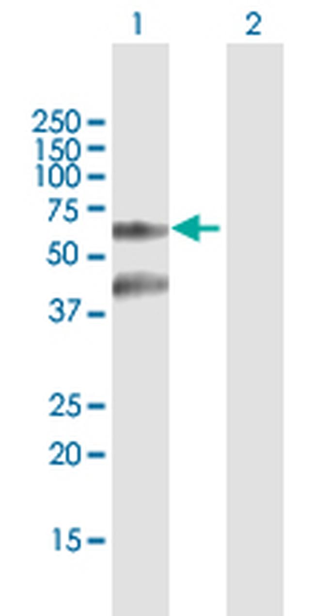 TTBK2 Antibody in Western Blot (WB)