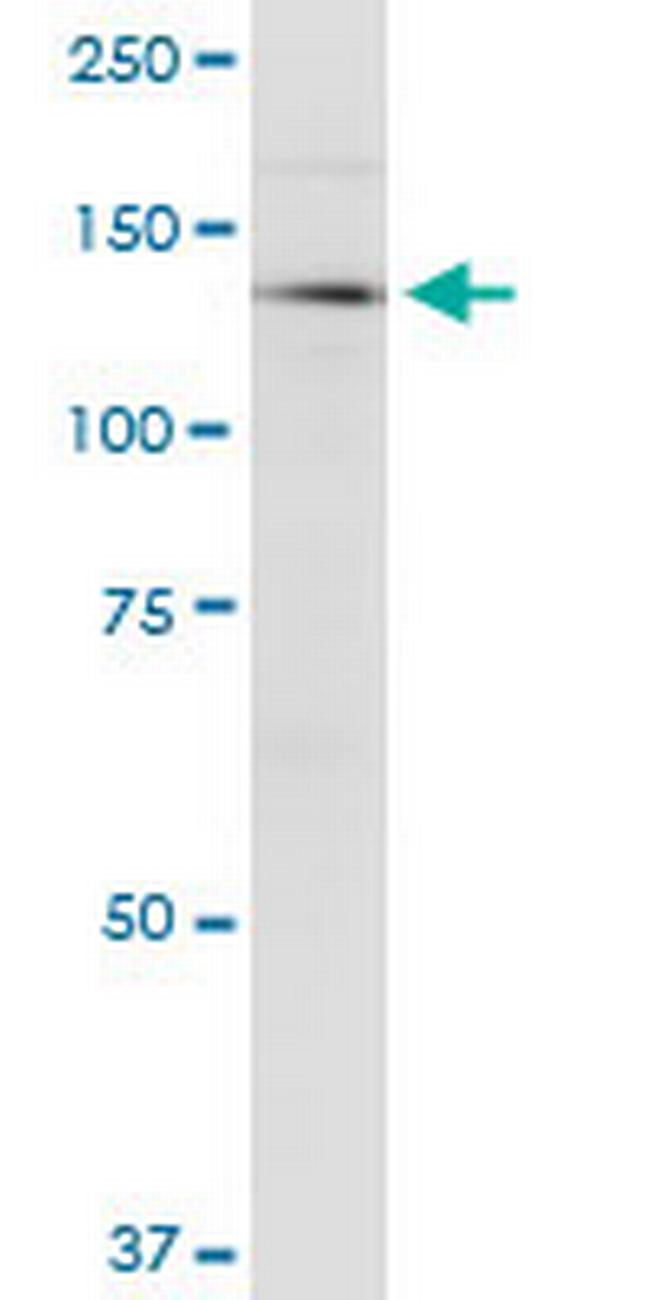 CDAN1 Antibody in Western Blot (WB)