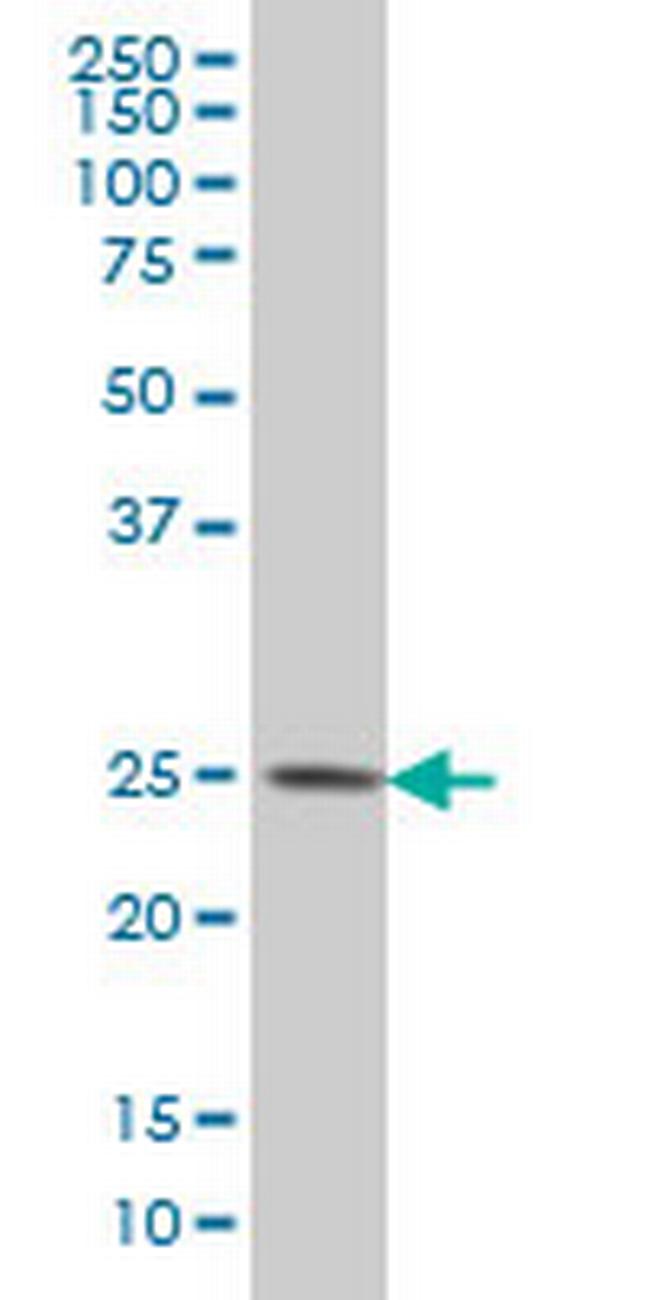 CKLFSF4 Antibody in Western Blot (WB)