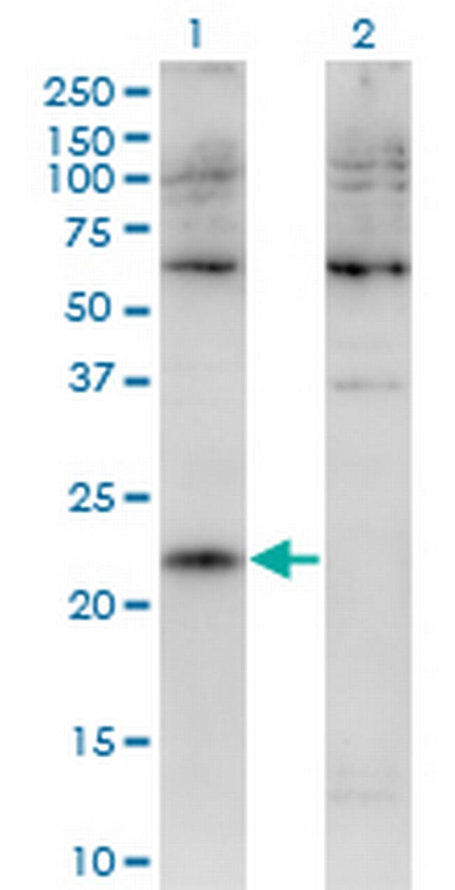 CMTM4 Antibody in Western Blot (WB)