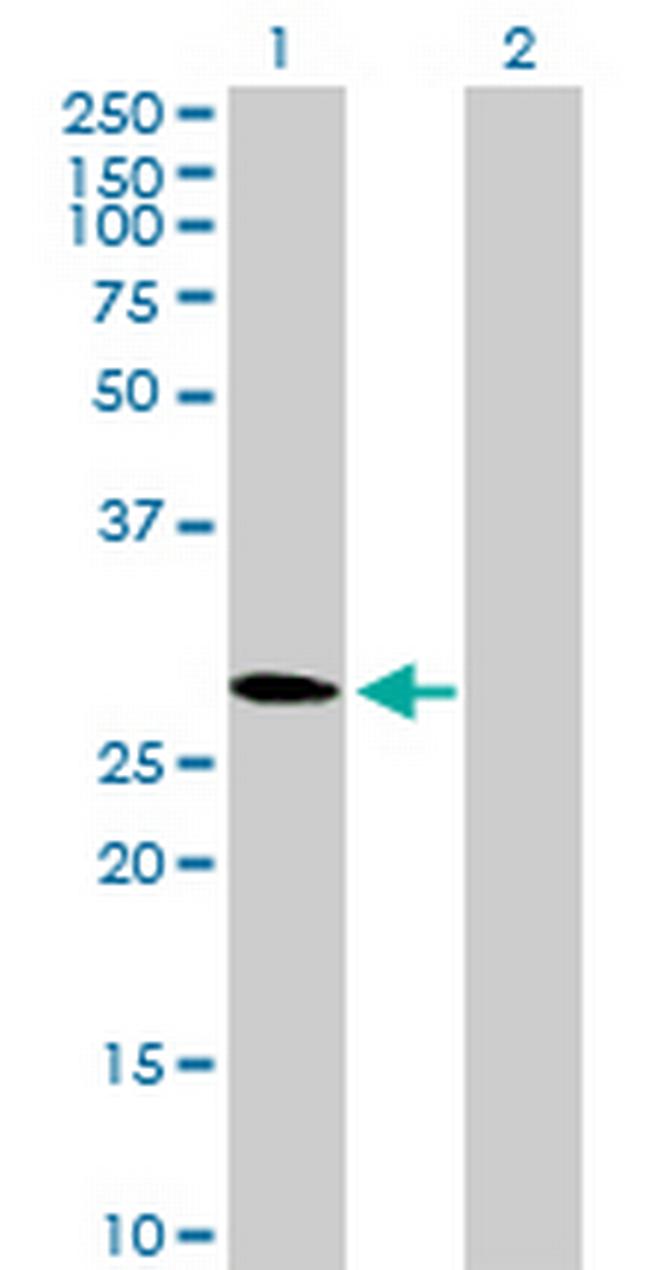 CMTM2 Antibody in Western Blot (WB)