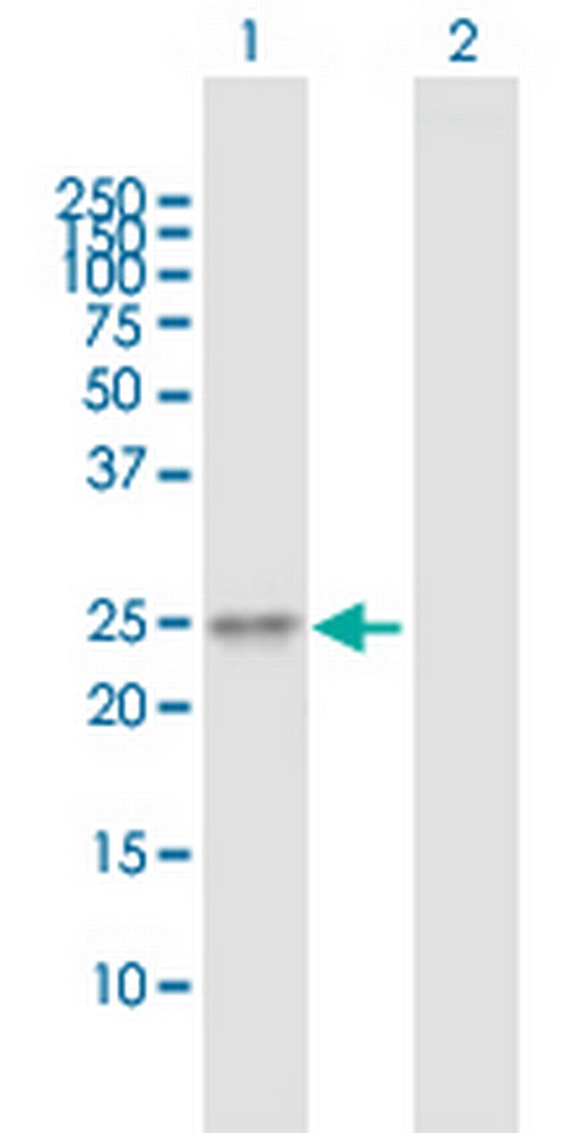 TMED6 Antibody in Western Blot (WB)
