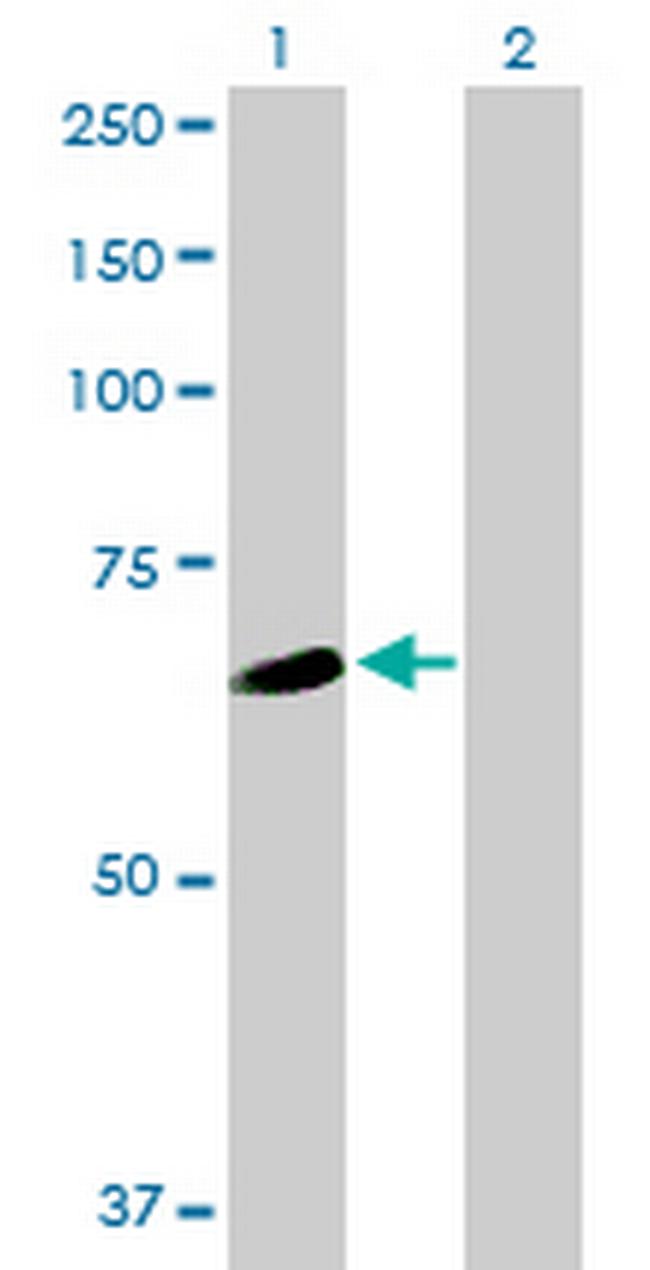 WDR16 Antibody in Western Blot (WB)