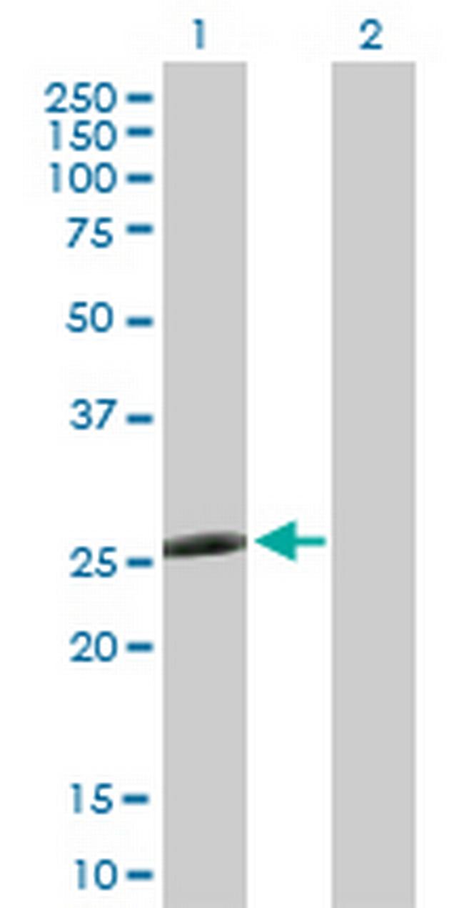 CCBE1 Antibody in Western Blot (WB)