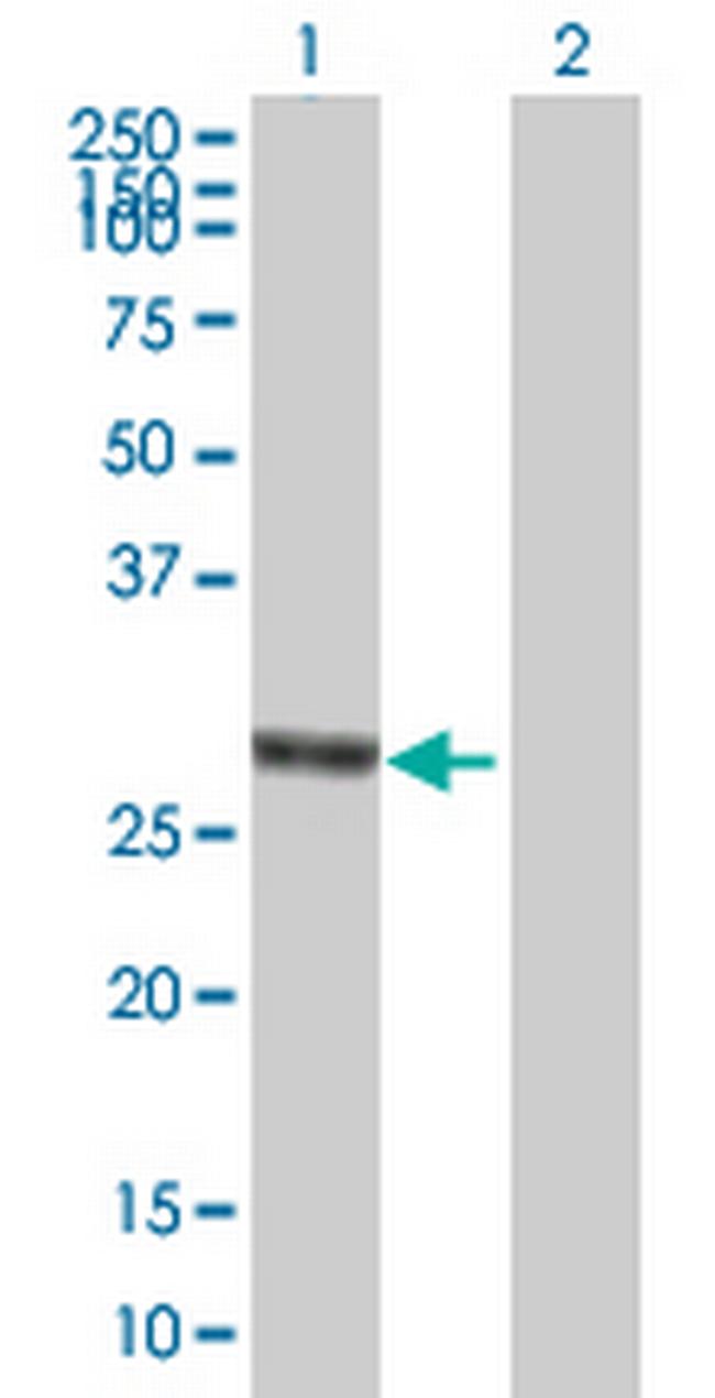 ANKRD29 Antibody in Western Blot (WB)
