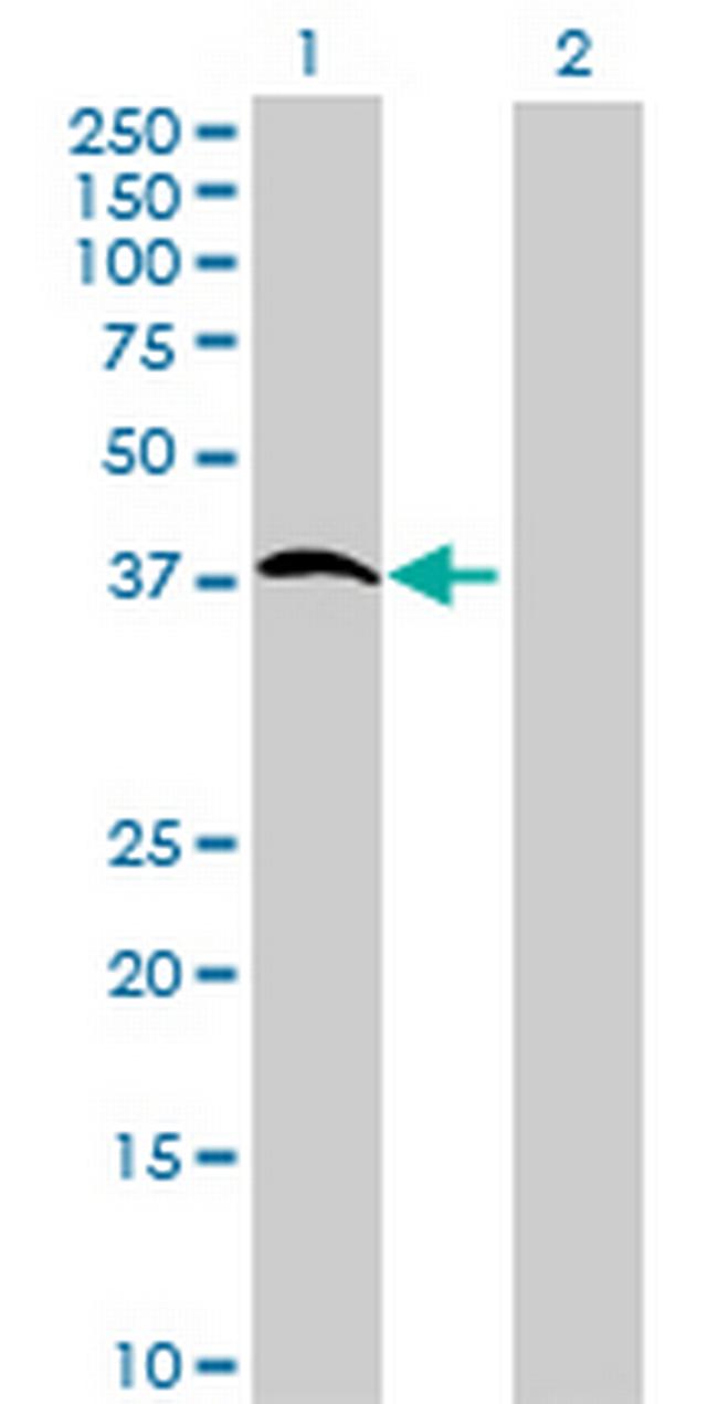 FLJ40125 Antibody in Western Blot (WB)