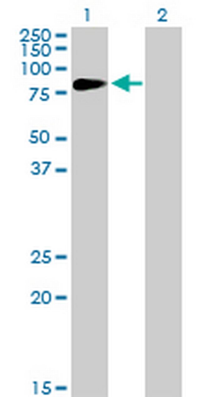 HIPK4 Antibody in Western Blot (WB)