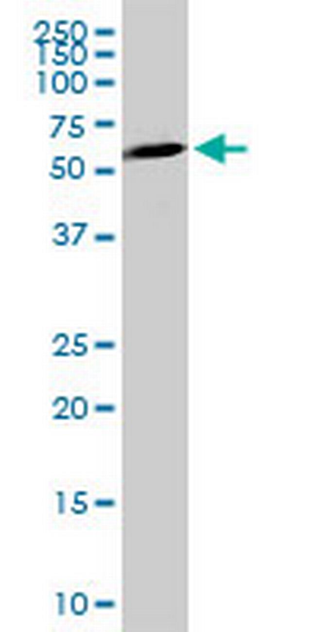 HIPK4 Antibody in Western Blot (WB)