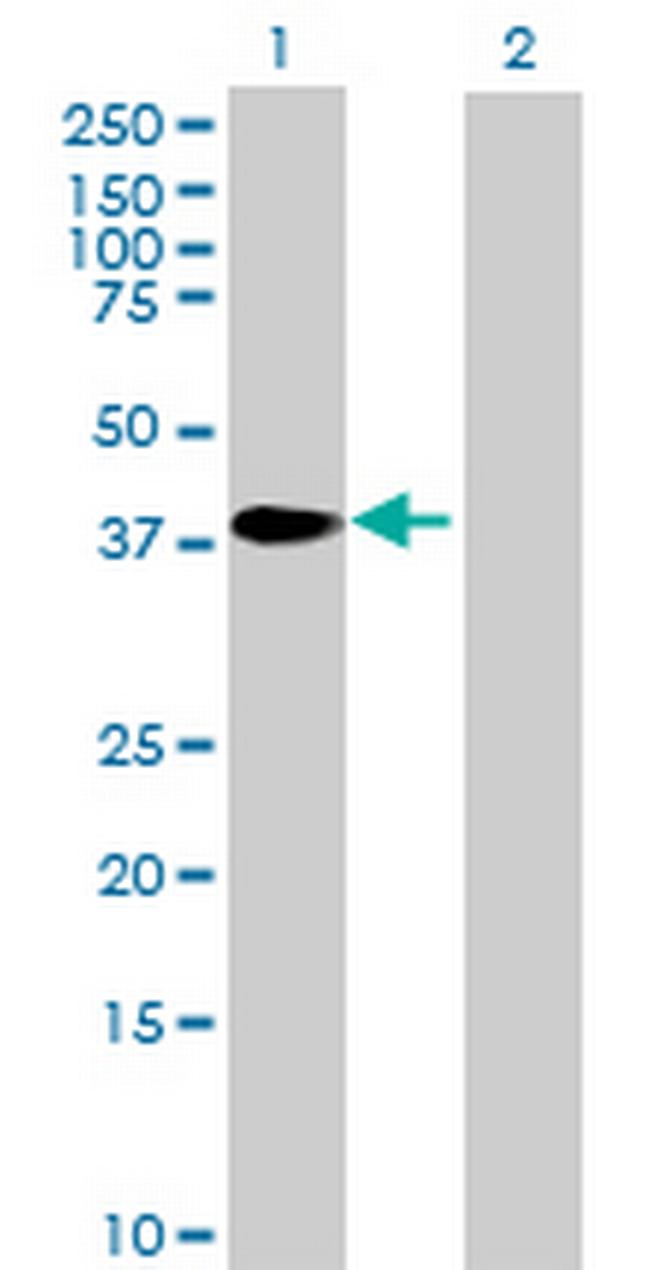 ZNF524 Antibody in Western Blot (WB)
