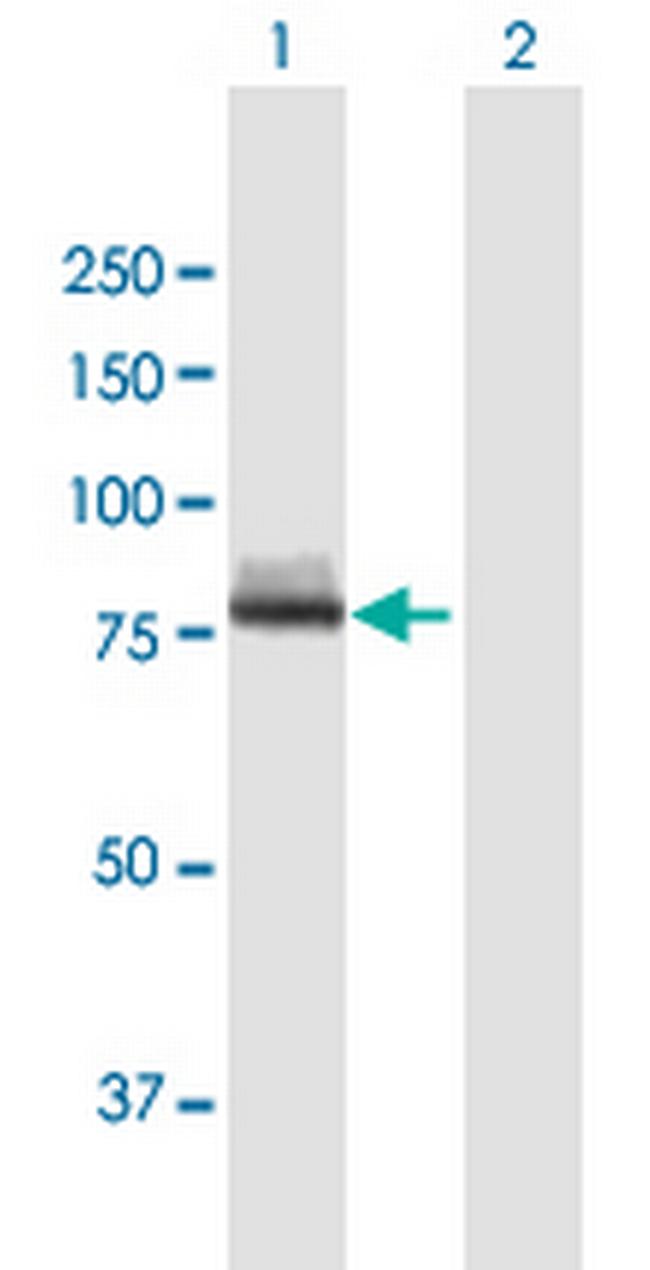 CAPN12 Antibody in Western Blot (WB)