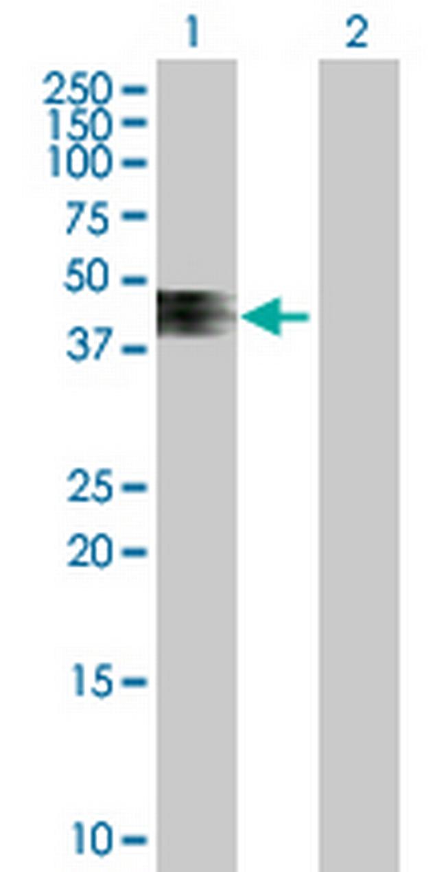 ZNRF4 Antibody in Western Blot (WB)