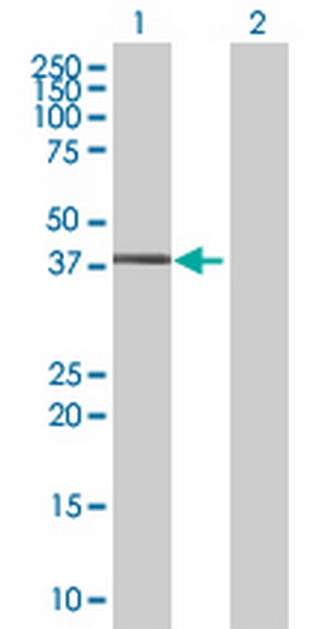 ZNF558 Antibody in Western Blot (WB)