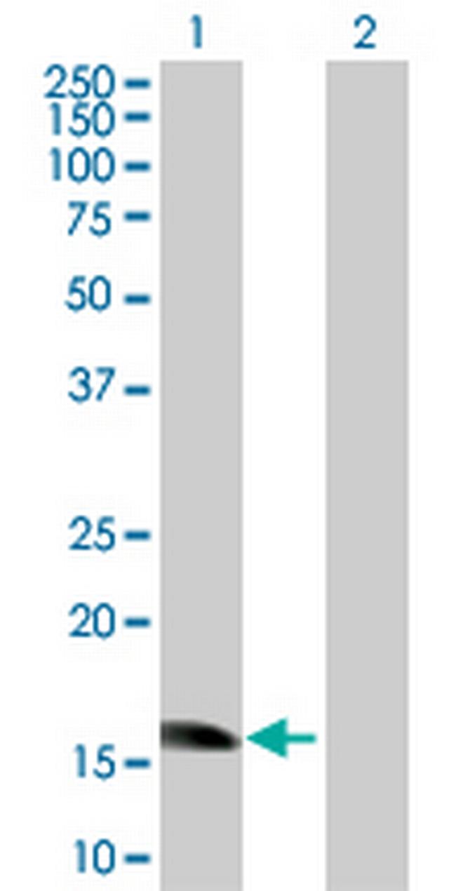 ZNF738 Antibody in Western Blot (WB)