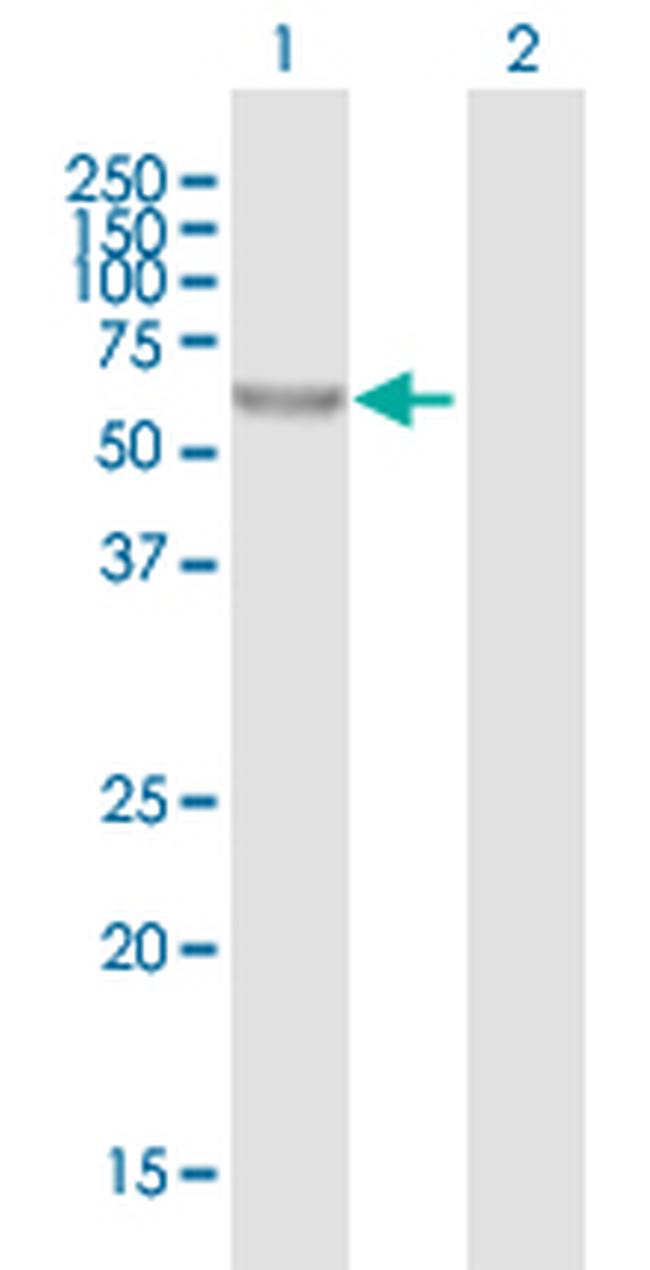 FLJ32569 Antibody in Western Blot (WB)