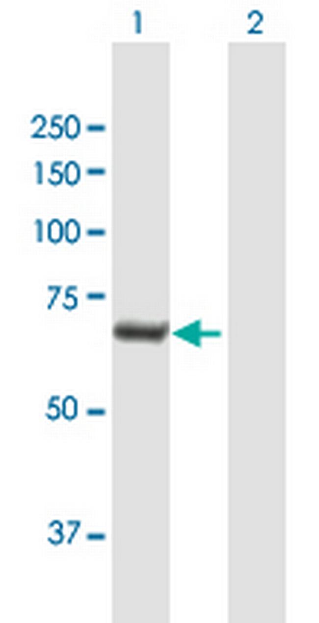 C20orf186 Antibody in Western Blot (WB)