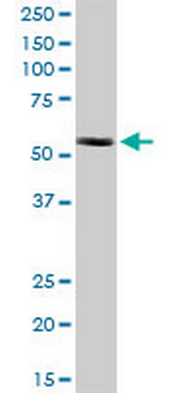 CCT8L2 Antibody in Western Blot (WB)