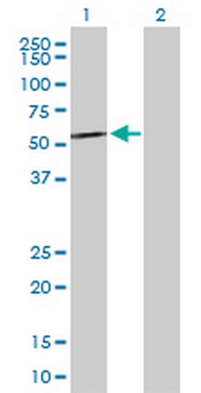 CCT8L2 Antibody in Western Blot (WB)