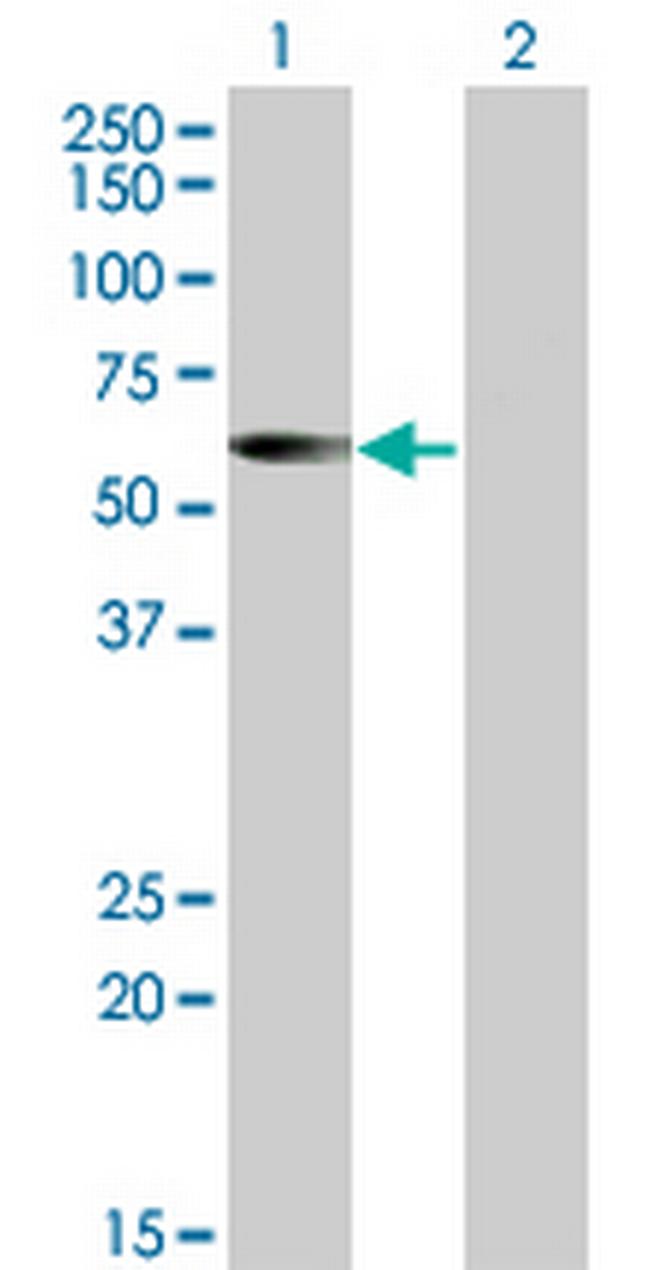 CESK1 Antibody in Western Blot (WB)