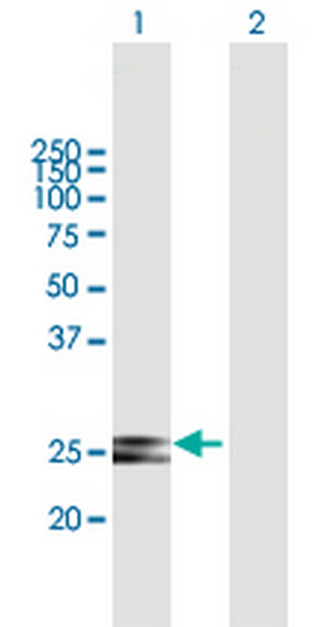 HSCB Antibody in Western Blot (WB)