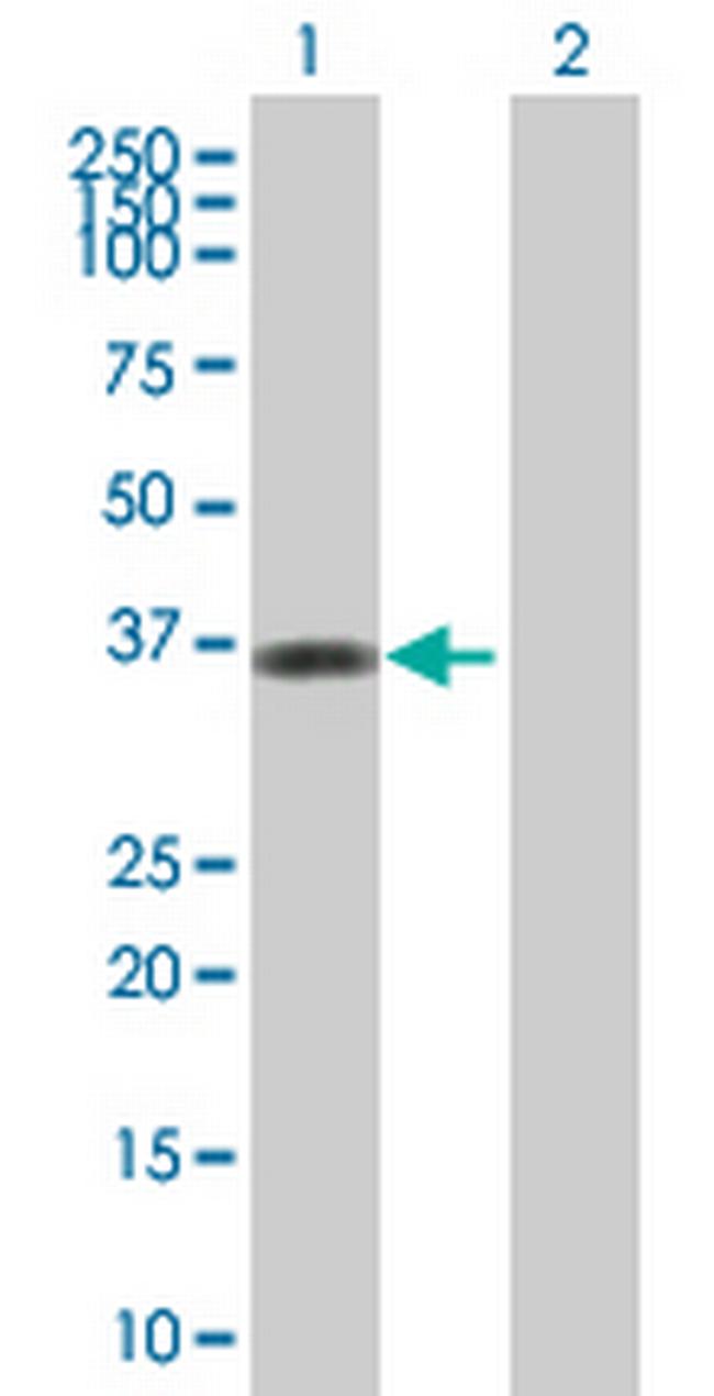 HORMAD2 Antibody in Western Blot (WB)