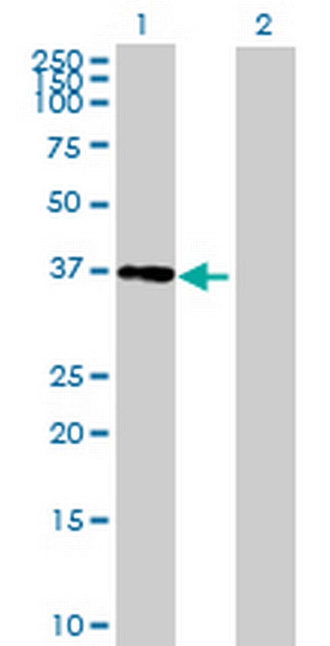 DNAJB7 Antibody in Western Blot (WB)