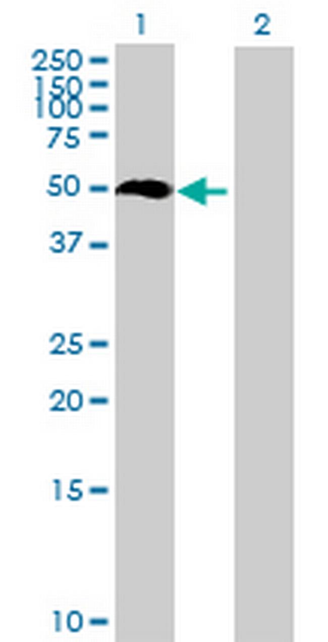 TEKT4 Antibody in Western Blot (WB)