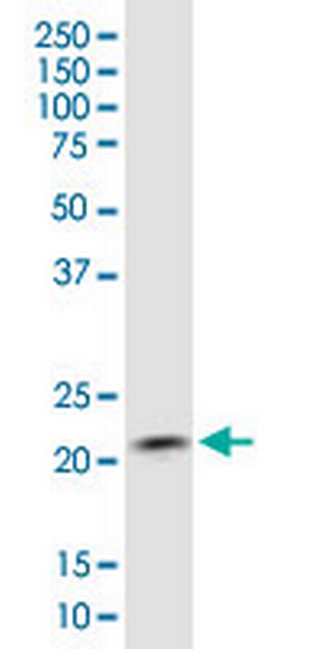COMMD1 Antibody in Western Blot (WB)