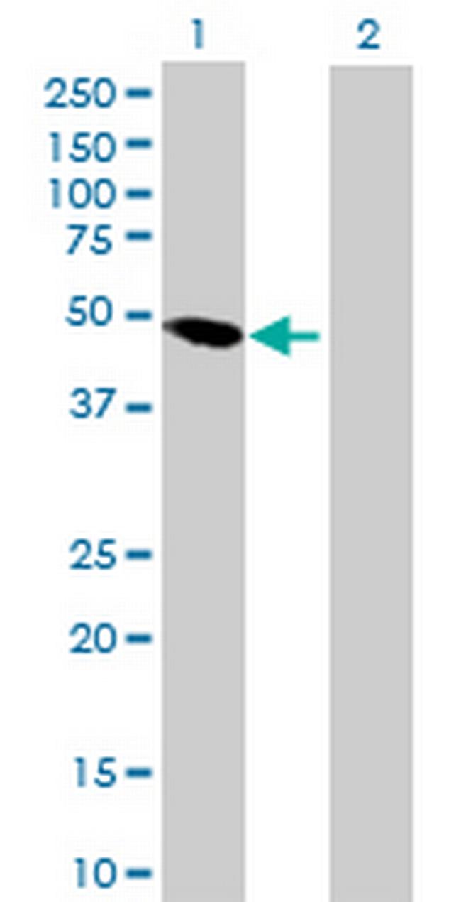 SEPT10 Antibody in Western Blot (WB)