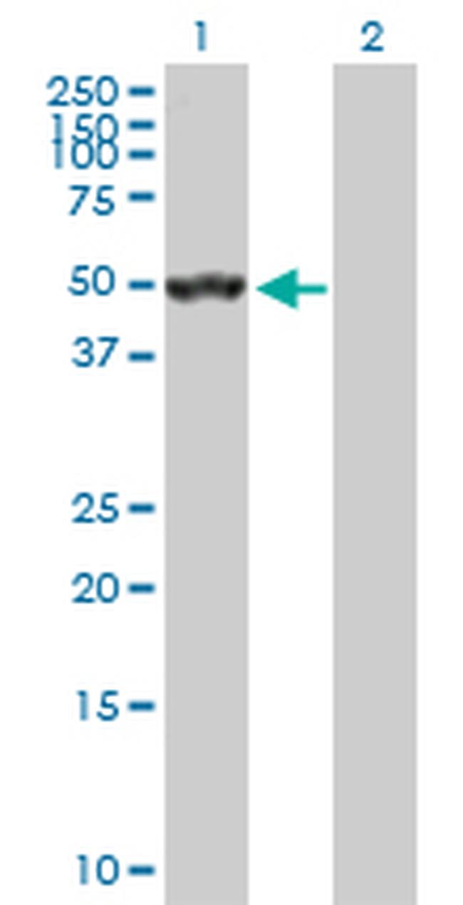 SEPT10 Antibody in Western Blot (WB)